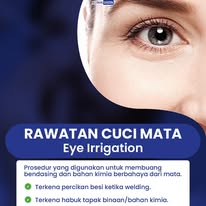Rawatan Cuci Mata